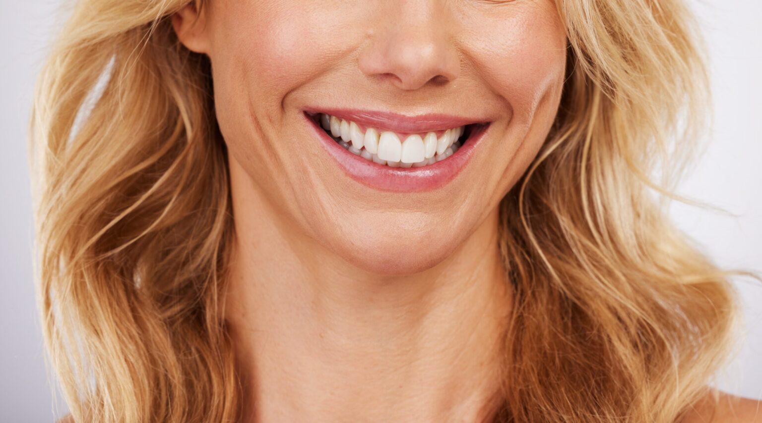 closeup of the lower half of a woman's face, dental veneers